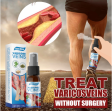 30ml Varicose Vein Spray Vasculitis Phlebitis Relief Cream